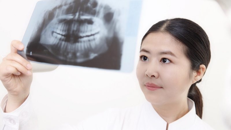 磨牙种植牙，这些注意事项你了解吗？**