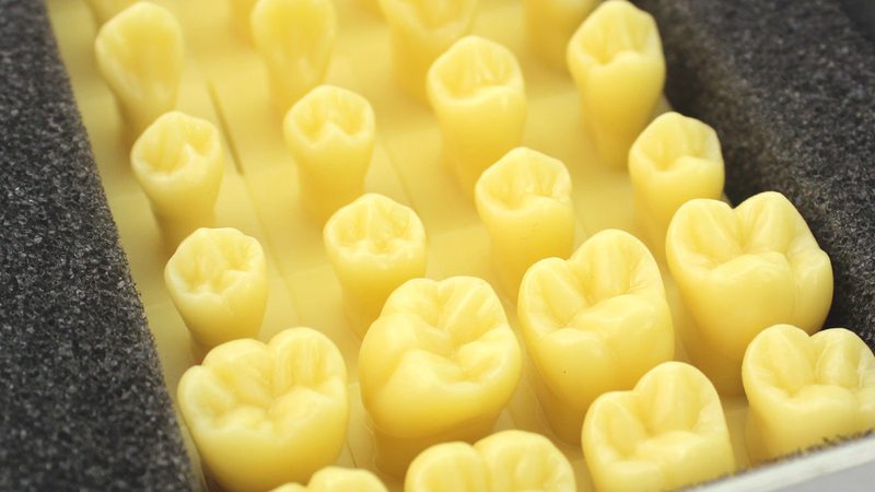 全瓷牙套想用医保报销，先搞清楚这几个关键点