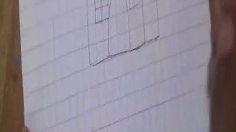牙周病拍片检查：了解价格前的关键信息**